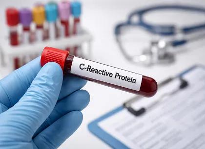C-reactive protein