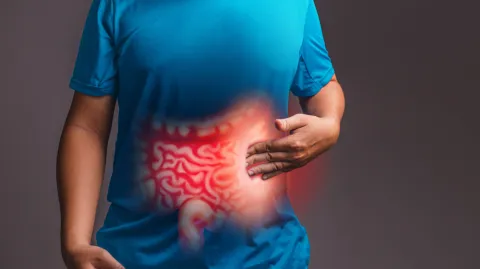 Combination Therapy Tied to Reduced Colon Cancer Risk in T2DM