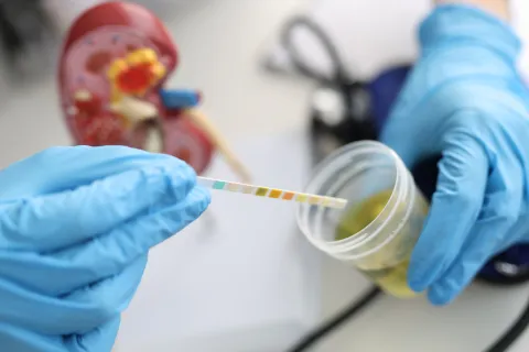 Finerenone Lowers Albuminuria in Type 1 Diabetes With CKD