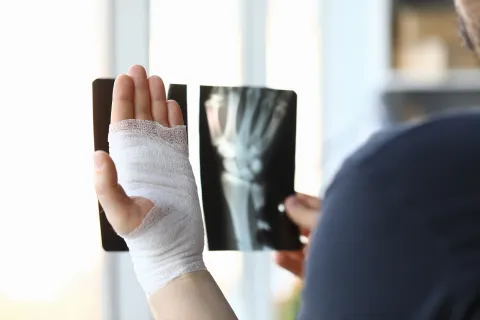 Fracture risk
