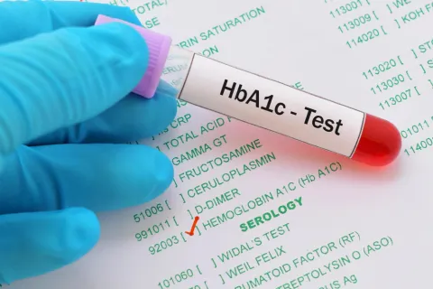 Lower HbA1c, Higher Risk? Microvascular Outcomes in T2DM Trial 