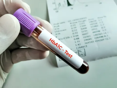 Higher HbA1c Levels Reflect Greater T2DM Complication Risk 