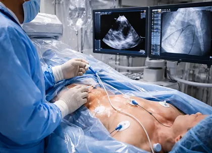 Intracardiac Echocardiography