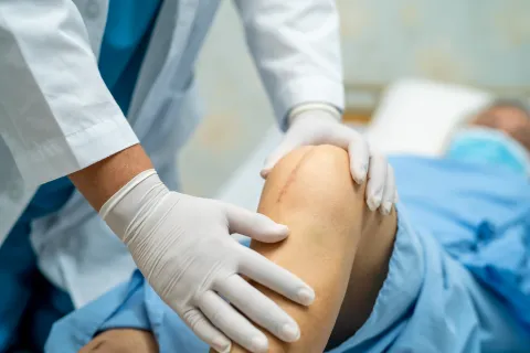 SGLT2 Inhibitor Use Linked to Higher Knee Replacement Risk