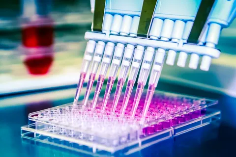 LC-MSMS-Based Model Differentiates Obesity and T2DM