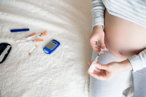 Midpregnancy GDM Screening Shows No Overall Outcome Gain