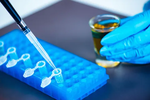 High Accuracy Seen With Multiplex Assays in T1DM Screening