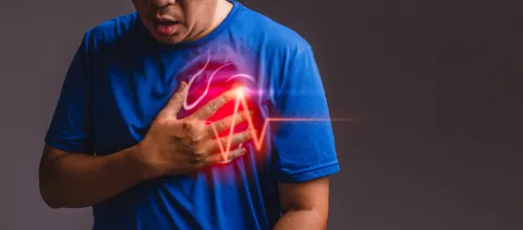 STEMI and NSTEMI Show Divergent Patterns in Type 1 Diabetes