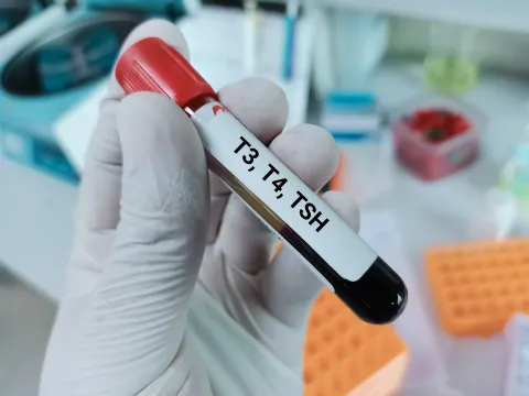 Nonlinear Links Seen Between Thyroid Markers and HbA1c in T2DM