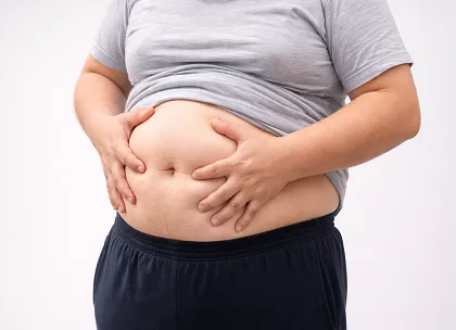 Obesity and Overweight