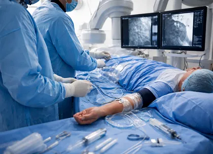 Percutaneous Coronary Intervention PCI