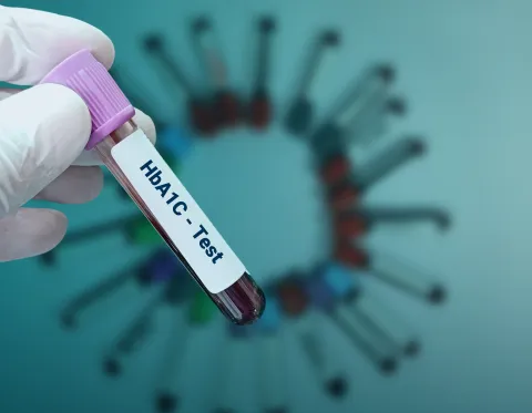 Stage 2 T1DM Progression Risk Similar in U.S. and Europe