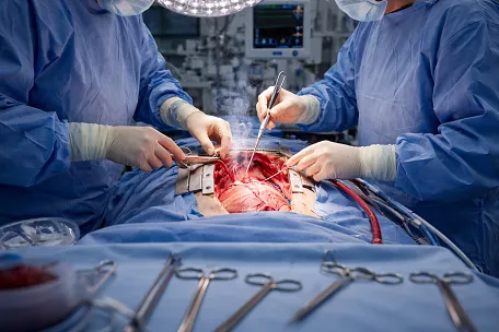 Surgery