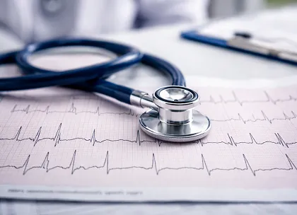 Atrial Fibrillation