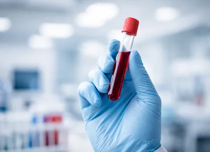 Blood Sample Test