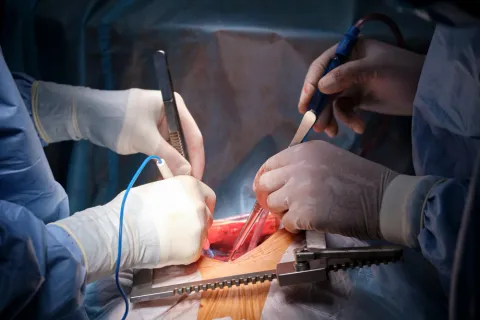 Cardiac Surgery