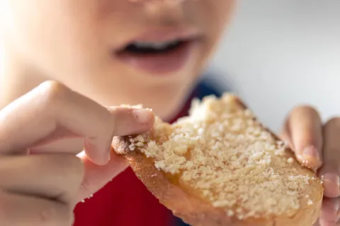 Children With T1DM Face Increased Celiac Disease Burden