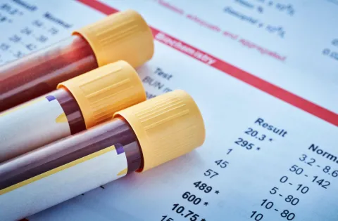 CHG-BMI Index Outperforms Traditional Markers for DKD Risk