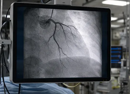 Occlusion