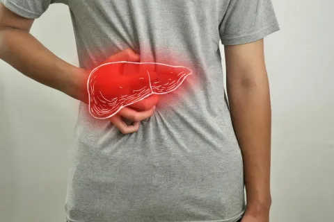 Semaglutide Shows No Link to Lower Cirrhosis or HCC Risk