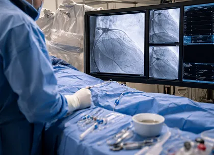 Angiogram