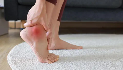 Foot Sensation Loss in DPN Linked to Smoking and CKD