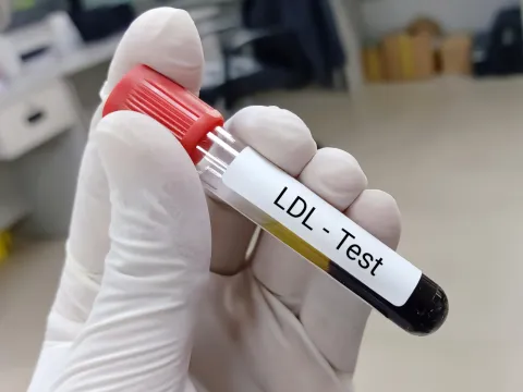 Dyslipidemia Evaluation and Screening: ACC/AHA Guideline (2026)