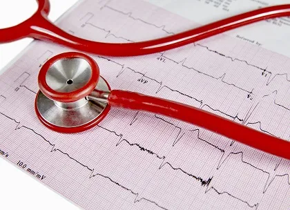 ECG