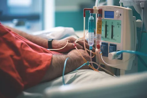 CGM Detected Dialysis-Cycle Glucose Patterns Beyond HbA1c