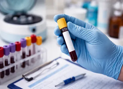 Lipid Testing
