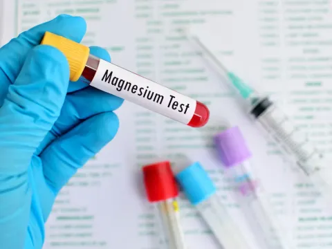 Low Magnesium Levels Seen in Poorly Controlled T2DM