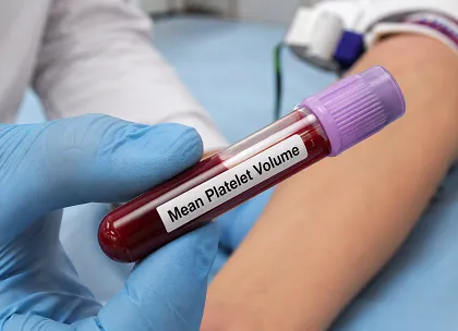 Mean Platelet Volume