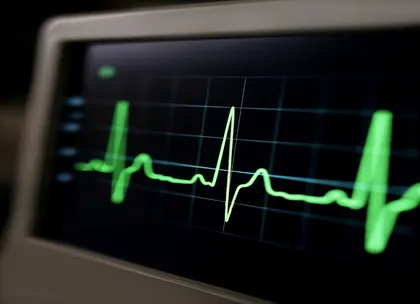 ECG