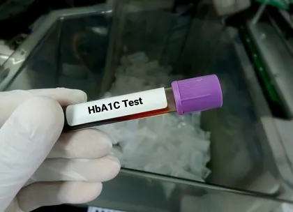 HbA1c test