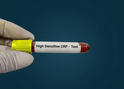HSCRP