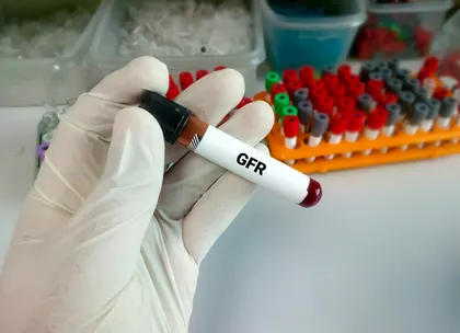 eGFR