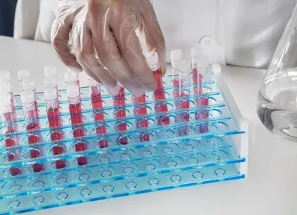 biomarker test