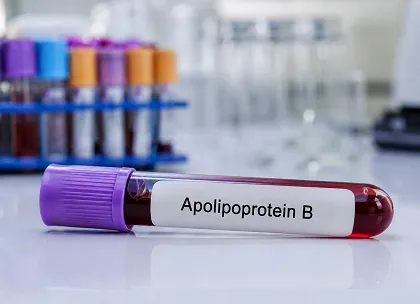 Apolipoprotein Test
