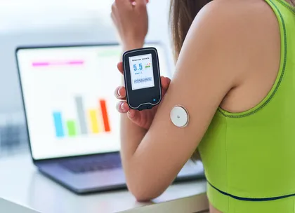 CGM