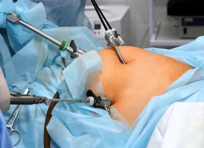 surgery