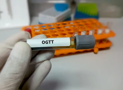 OGTT