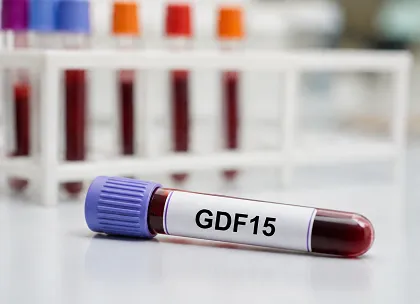 GDF15 Testing