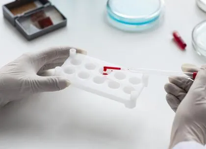blood test