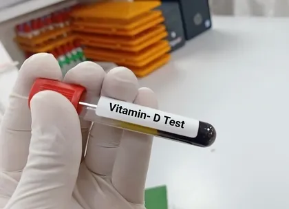 vitamin D 