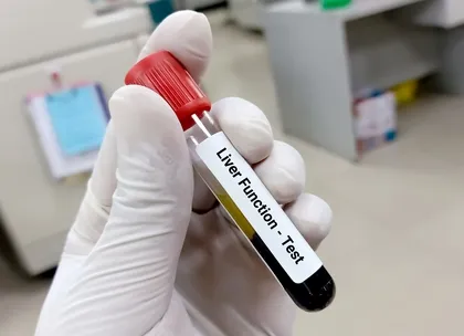 liver function test