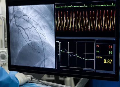 Angiography