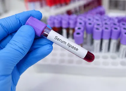Lipase