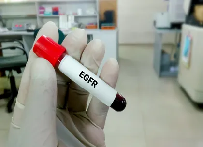 eGFR