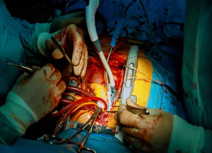 heart surgery