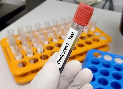 cholesterol 